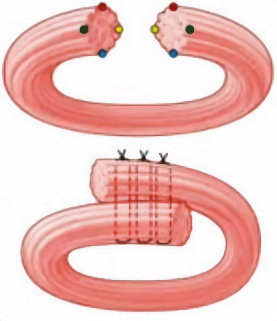 Cirurgia de esfincteroplastia
